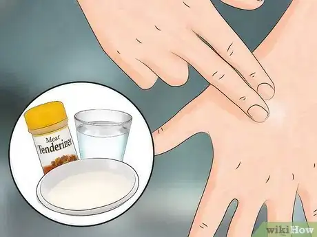 Image intitulée Reduce the Pain of Gnat Bites Step 6