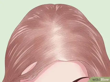 Image intitulée Prevent Hair Loss Due to Stress Step 1