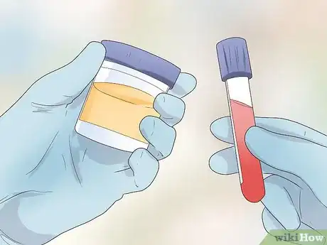 Image intitulée Pass a Drug Test With Home Remedies Step 11