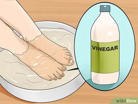 Image intitulée Get Rid of Yellow Toenails Step 12