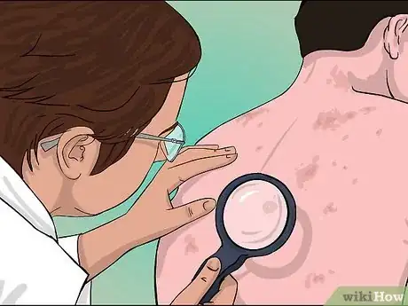 Image intitulée Check for Skin Cancer Step 6