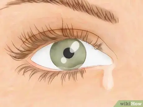 Image intitulée Treat Dry Eyes Step 1