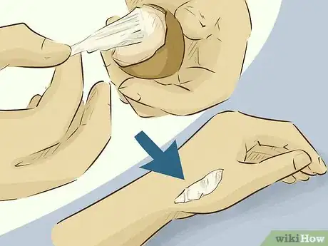 Image intitulée Stop Bleeding Step 13