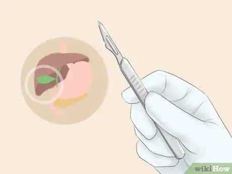 Image intitulée Relieve Biliary Colic Pain Step 10