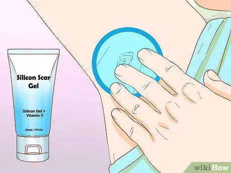 Image intitulée Get Rid of Boil Scars Step 2