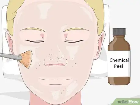 Image intitulée Clean Clogged Pores Step 4