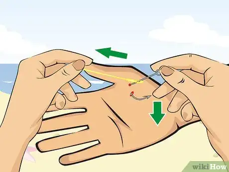 Image intitulée Pull a Fish Hook from Your Finger Step 14