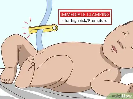 Image intitulée Cut the Umbilical Cord of a Baby Step 2