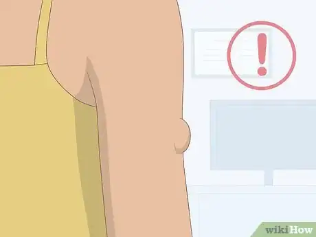 Image intitulée Know if You Have a Lipoma Step 1