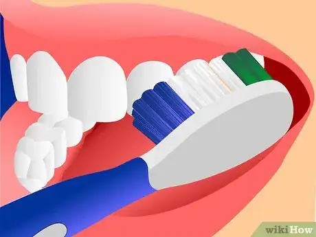 Image intitulée Get Rid of Gingivitis Step 5