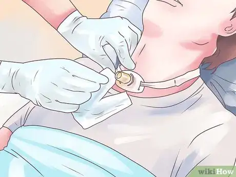 Image intitulée Perform Tracheostomy Care Step 17