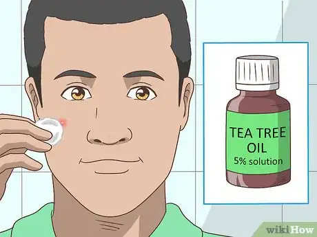 Image intitulée Get Rid of a Pimple Step 10