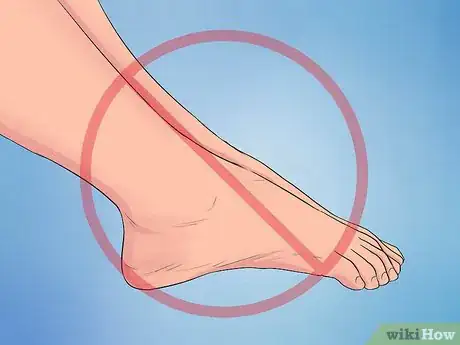 Image intitulée Treat Plantar Fasciitis Step 14