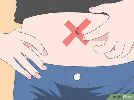 Image intitulée Treat an Infection in Your Belly Button Step 10