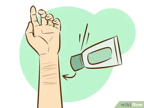 Image intitulée Get Rid of Self Harm Scars Step 17