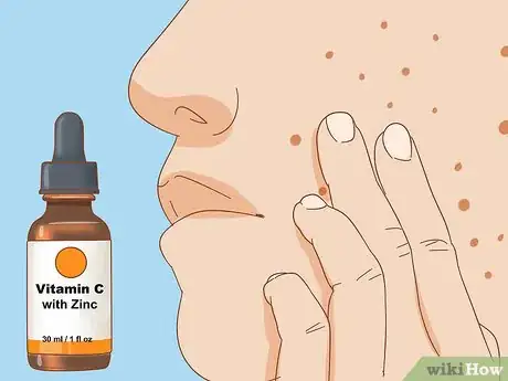 Image intitulée Apply Vitamin C Serum for Facial Skin Care Step 7