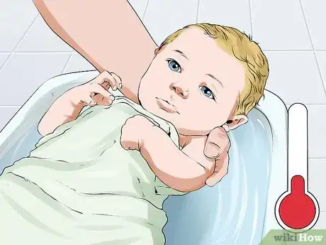 Image intitulée Treat Baby Eczema Step 3