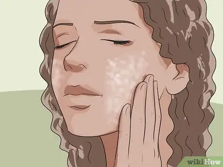Image intitulée Get Rid of Pimples Naturally (Sea Salt Method) Step 27