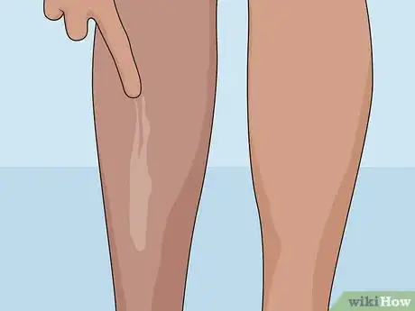 Image intitulée Remove Scars on Legs Step 06