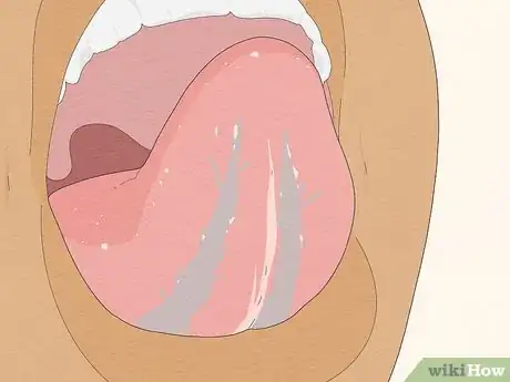 Image intitulée Pierce Your Own Tongue Step 6