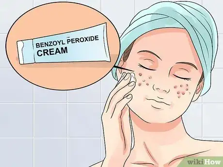 Image intitulée Clear Mild Acne Fast Step 1