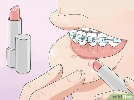 Image intitulée Make Your Braces Hurt Less Step 10