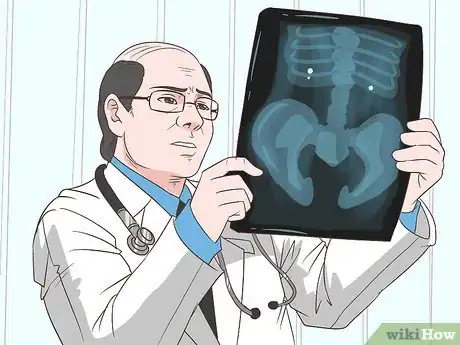 Image intitulée Treat Kidney Pain Step 11