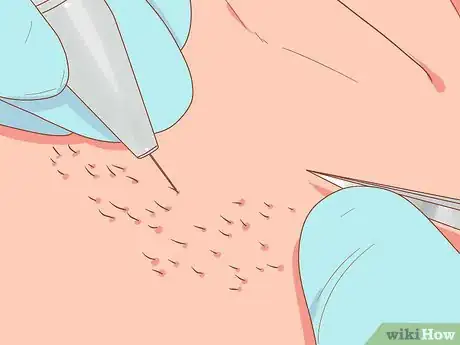 Image intitulée Reduce Unwanted Facial Hair Step 5