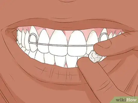Image intitulée Heal a Bitten Tongue Step 21