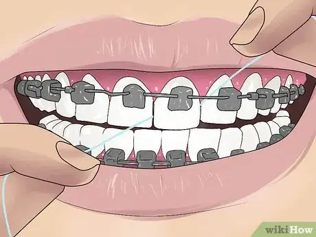 Image intitulée Use an Electric Toothbrush with Braces Step 16