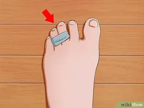 Image intitulée Fix Painful Shoes Step 20