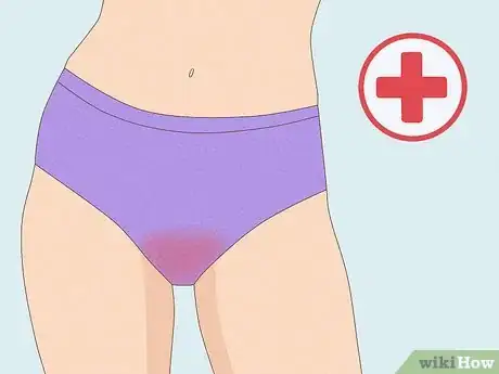 Image intitulée Apply Vaginal Cream Step 9