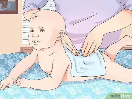 Image intitulée Treat Infant Eczema Naturally Step 7