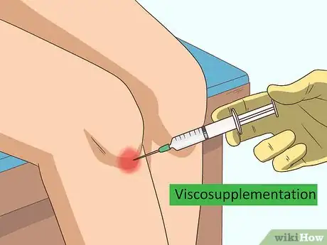 Image intitulée Increase Synovial Fluid Step 19