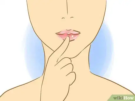 Image intitulée Stop Picking Your Lips Step 4