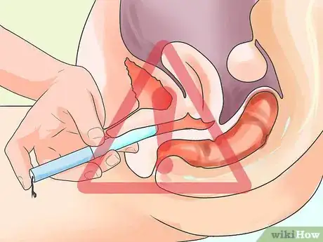Image intitulée Know if You Have Toxic Shock Syndrome Step 7