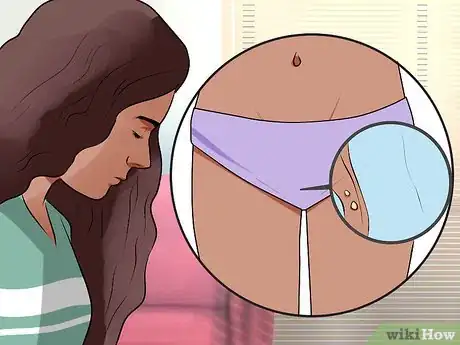 Image intitulée Recognize Vulva Cancer Symptoms Step 3