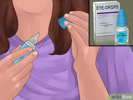 Image intitulée Apply Eye Drops in a Parrot's Eye Step 2