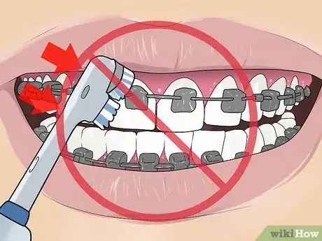 Image intitulée Use an Electric Toothbrush with Braces Step 14