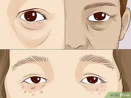 Image intitulée Improve Under Eye Skin Step 17.jpeg