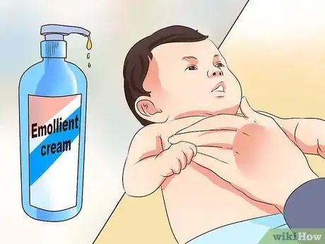 Image intitulée Treat Infant Eczema Naturally Step 8