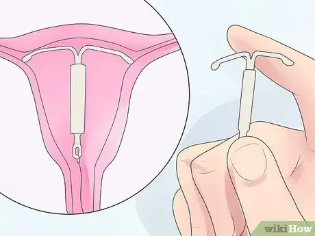 Image intitulée Get Birth Control Without Parents Knowing Step 7