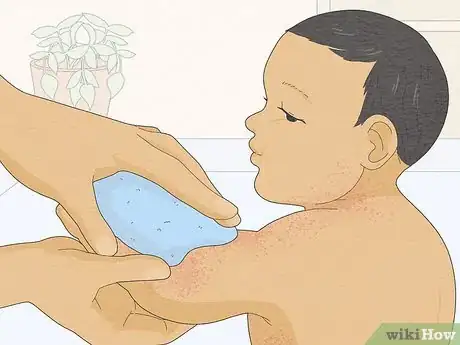 Image intitulée Treat Baby Heat Rash Step 4