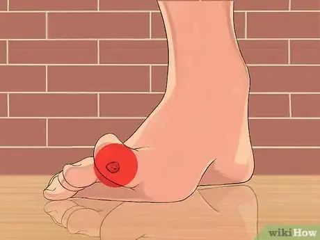 Image intitulée Get Rid of Plantar Warts (Verrucas) Step 14