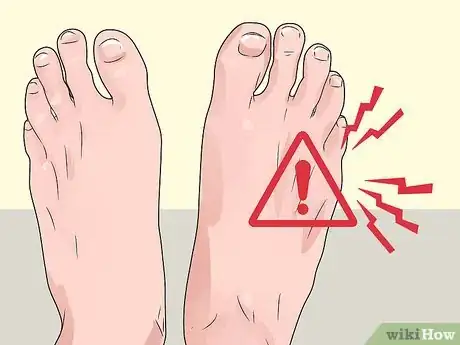 Image intitulée Check Feet for Complications of Diabetes Step 2