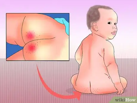 Image intitulée Treat Diarrhea in Newborns Step 15