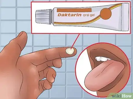 Image intitulée Treat Oral Thrush Step 12