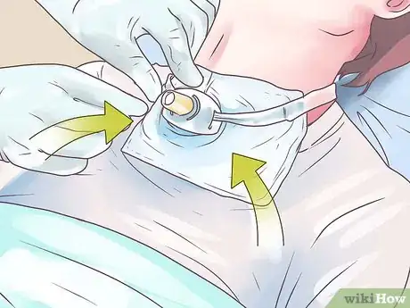 Image intitulée Perform Tracheostomy Care Step 18