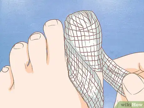 Image intitulée Help a Toenail Grow Back Quickly Step 2