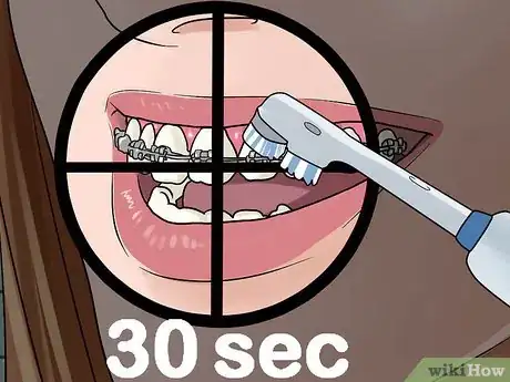 Image intitulée Use an Electric Toothbrush with Braces Step 8